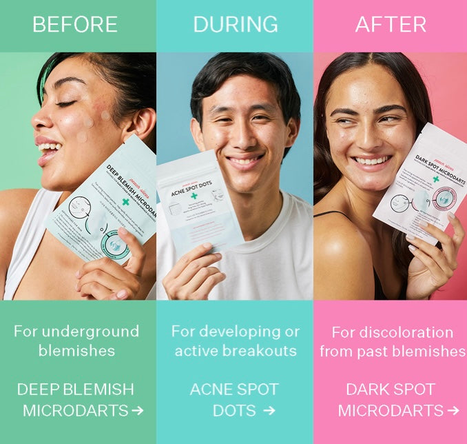 Acne spot- Deep Blemish Microdart – Clea Wellness Solutions